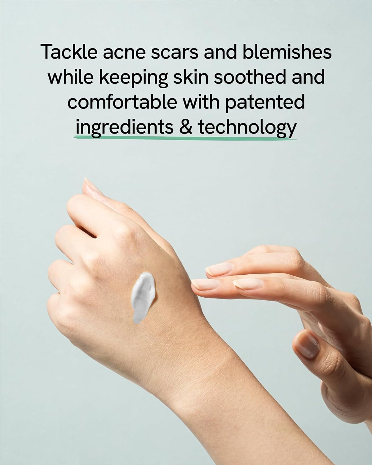 Blemish Treatment (0.7Fl Oz) - Post-Blemish Marks, Correction Korean Skin Care. TECA, Allantoin, Herb-Vinegar Tincture.