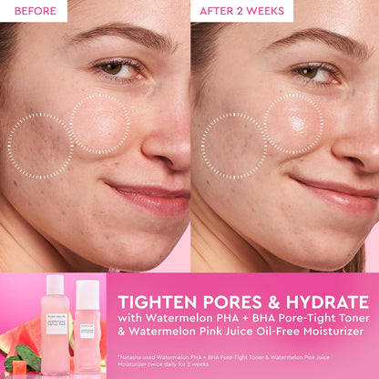Pink Juice Watermelon Water-Gel Moisturiser