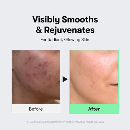 VT CICA Reedle Shot Microneedling Serum