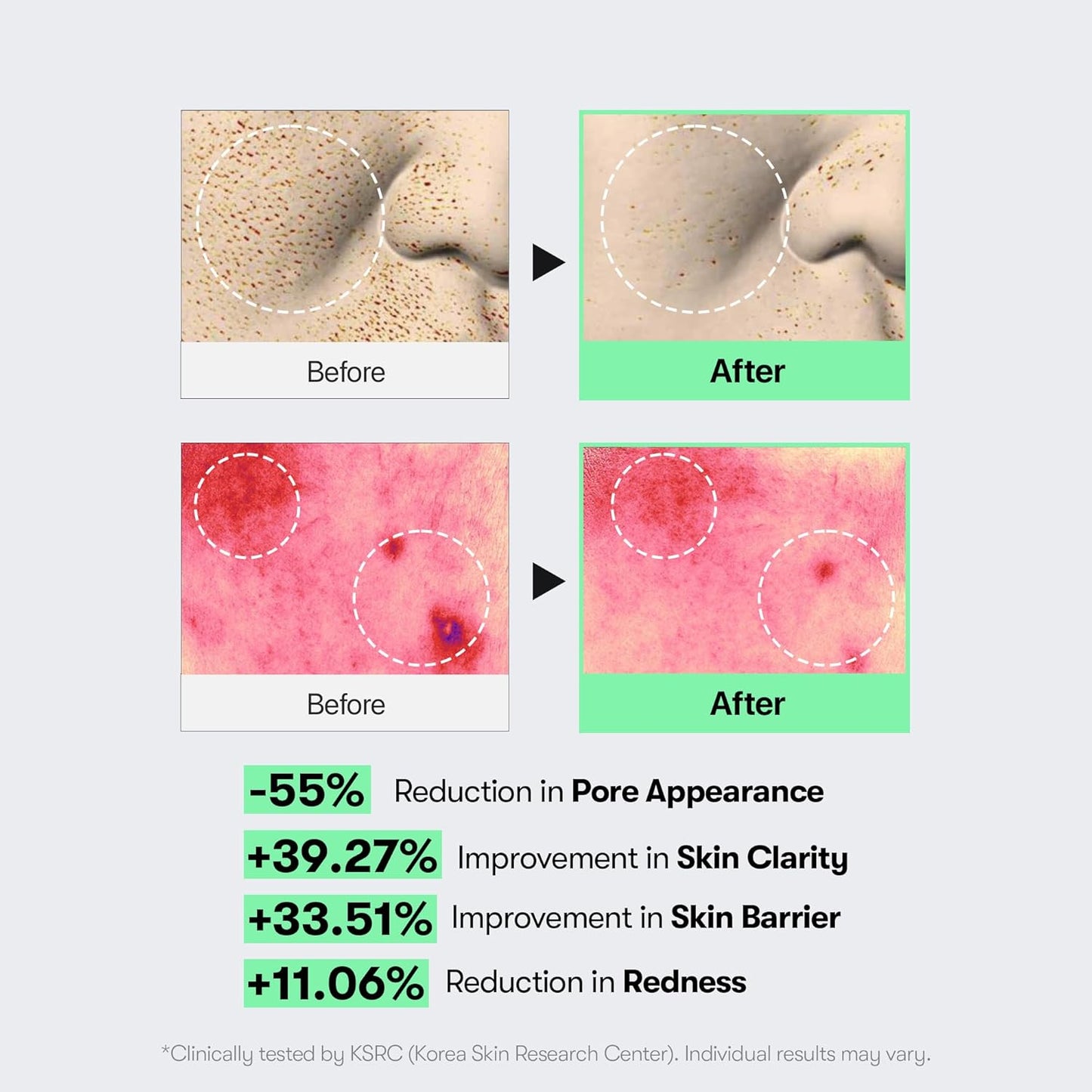 VT CICA Reedle Shot Microneedling Serum