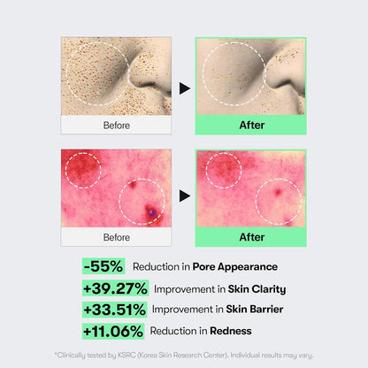 VT CICA Reedle Shot Microneedling Serum